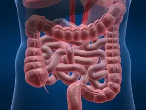 Irritable Bowel Syndrome