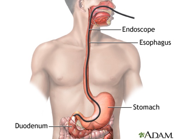 A graphic showing the GI tract