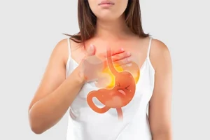 Gastroesophageal reflux disease (GERD) 
